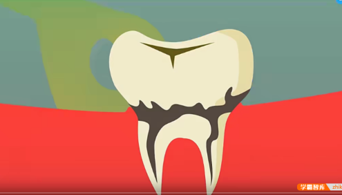 【芝麻学社】ahashool少儿护牙必修课